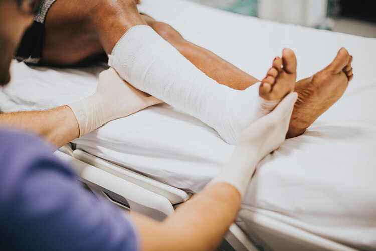 Person with an injured leg in a cast